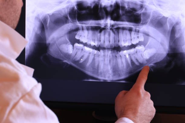 Best Knocked-Out Tooth Emergency  in Vero Beach South, FL