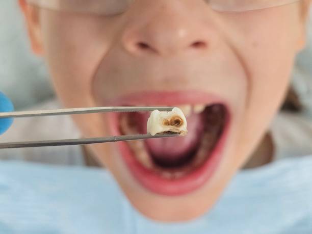 Best Emergency Gum Pain Relief  in Vero Beach South, FL